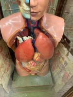 1910 Anatomical Medical Figure (3 of 9) 1910 Anatomical Medical Figure (3 of 9)