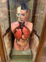 1910 Anatomical Medical Figure (2 of 9) 1910 Anatomical Medical Figure (2 of 9)